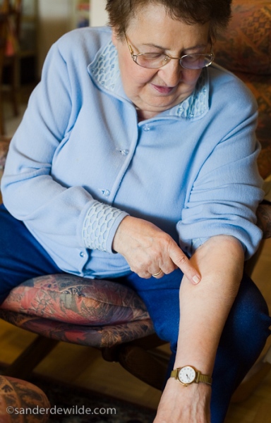 WW II victim got rid of tattoos